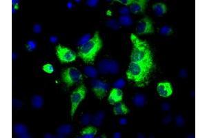 Anti-LOX mouse monoclonal antibody (ABIN2453266) immunofluorescent staining of COS7 cells transiently transfected by pCMV6-ENTRY LOX (RC213323). (LOX Antikörper  (AA 22-168))