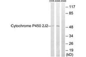 Western Blotting (WB) image for anti-Cytochrome P450, Family 2, Subfamily J, Polypeptide 2 (CYP2J2) (AA 231-280) antibody (ABIN2889947) (CYP2J2 Antikörper  (AA 231-280))