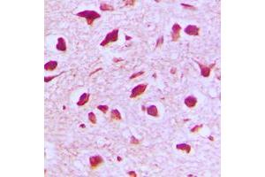 Immunohistochemical analysis of RANBP6 staining in human brain formalin fixed paraffin embedded tissue section. (RANBP6 Antikörper  (Center))