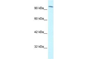 Human Jurkat; WB Suggested Anti-SMARCC1 Antibody Titration: 1. (SMARCC1 Antikörper  (C-Term))
