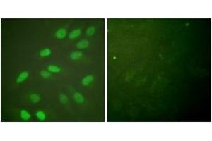 Immunofluorescence analysis of HeLa cells, using Lamin A/C (Ab-392) Antibody.