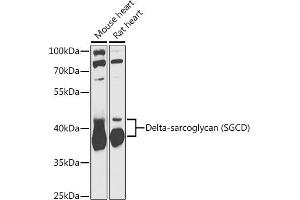 Western blot analysis of extracts of various cell lines, using Delta-sarcoglycan (Delta-sarcoglycan (SGCD)) antibody (ABIN6130325, ABIN6147699, ABIN6147701 and ABIN6217312) at 1:1000 dilution. (SGCD Antikörper  (AA 61-290))