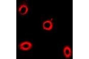 Immunofluorescent analysis of HIP1 staining in U2OS cells. (HIP1 Antikörper)