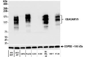 Western Blotting (WB) image for anti-Carcinoembryonic Antigen-Related Cell Adhesion Molecule 1/5 (CEACAM1/5) (AA 35-433) antibody (ABIN7453963)