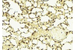 ABIN6274326 at 1/100 staining Mouse lung tissue by IHC-P. (AKAP13 Antikörper  (Internal Region))