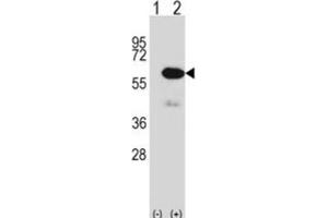 Western Blotting (WB) image for anti-Methionyl Aminopeptidase 2 (METAP2) antibody (ABIN2997955) (METAP2 Antikörper)