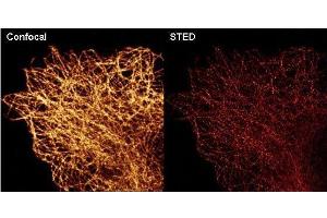 Immunofluorescence (IF) image for anti-alpha Tubulin (TUBA1) (C-Term) antibody (ABIN964563)