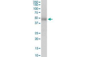 Western Blotting (WB) image for anti-Purinergic Receptor P2X, Ligand-Gated Ion Channel, 5 (P2RX5) (AA 1-422) antibody (ABIN518568)