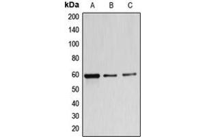 Western blot analysis of B4GALNT1 expression in MDAMB453 (A), A549 (B), K562 (C) whole cell lysates.