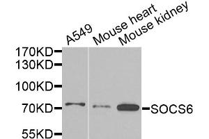 Western blot analysis of extracts of various cell lines, using SOCS6 antibody. (SOCS6 Antikörper)