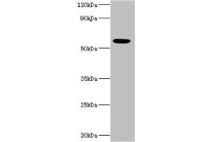 Western blot All lanes: IFNAR2 antibody at 10 μg/mL + MCF-7 whole cell lysate Secondary Goat polyclonal to rabbit IgG at 1/10000 dilution Predicted band size: 58, 38, 28 kDa Observed band size: 58 kDa (IFNAR2 Antikörper  (AA 27-243))