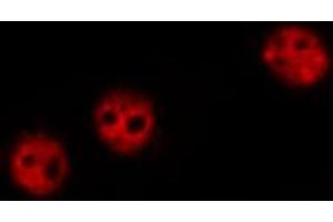 Immunofluorescence (fixed cells) (IF/ICC) image for anti-Nuclear Factor of kappa Light Polypeptide Gene Enhancer in B-Cells 1 (NFKB1) (pSer337) antibody (ABIN6256276)