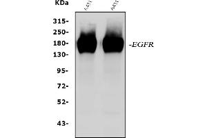 Western blot analysis of EGFR using anti-EGFR antibody (ABIN5518909). (EGFR Antikörper  (N-Term))
