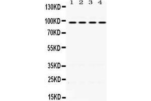 Western Blotting (WB) image for anti-Programmed Cell Death 6 Interacting Protein (PDCD6IP) (AA 2-330) antibody (ABIN3043596)