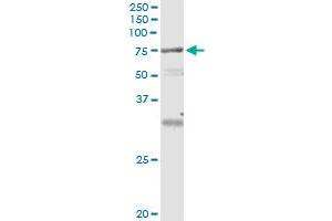 Immunoprecipitation (IP) image for anti-Vacuolar Protein Sorting 18 Homolog (VPS18) (AA 3-101) antibody (ABIN961169) (VPS18 Antikörper  (AA 3-101))