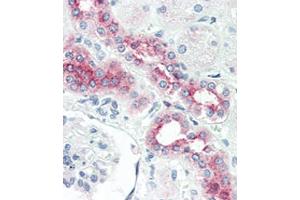 Immunohistochemistry (Paraffin-embedded Sections) (IHC (p)) image for anti-Bone Morphogenetic Protein Receptor, Type II (serine/threonine Kinase) (BMPR2) (AA 28-59), (N-Term) antibody (ABIN388741)