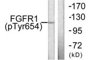 Western blot analysis of extracts from 293 cells treated with Insulin 0. (FGFR1 Antikörper  (pTyr654))