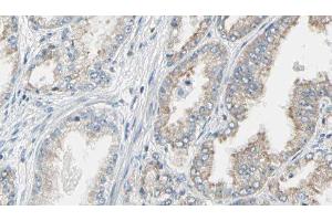 Immunohistochemistry (IHC) image for anti-rho GDP Dissociation Inhibitor (GDI) alpha (ARHGDIA) (N-Term) antibody (ABIN6260030)