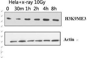 Western Blot (WB) analysis: Please contact us for more details. (Histone 3 Antikörper  (H3K9me3))