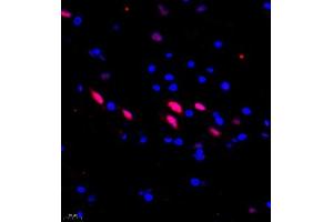 Immunofluorescence of paraffin embedded rat spinal cord using USP27 (ABIN7076113) at dilution of 1:1500 (400x lens) (USP27X Antikörper)