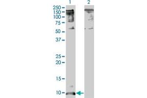 Western Blot analysis of CXCL5 expression in transfected 293T cell line by CXCL5 monoclonal antibody (M05A), clone 2A9. (CXCL5 Antikörper  (AA 1-114))
