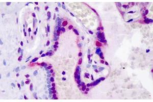 Immunohistochemistry (Formalin-fixed Paraffin-embedded Sections) (IHC (fp)) image for anti-Leo1, Paf1/RNA Polymerase II Complex Component, Homolog (S. Cerevisiae) (LEO1) (pSer10) antibody (ABIN6745768)