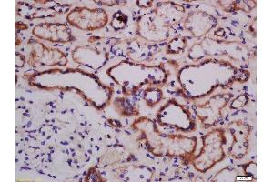 Formalin-fixed and paraffin embedded human kidney labeled with Anti-ATG101 Polyclonal Antibody, Unconjugated  at 1:300 followed by conjugation to the secondary antibody and DAB staining. (ATG101 Antikörper  (AA 121-218))