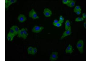 Immunofluorescence staining of HepG2 cells with ABIN7174068 at 1:166, counter-stained with DAPI. (SYK Antikörper  (AA 260-361))
