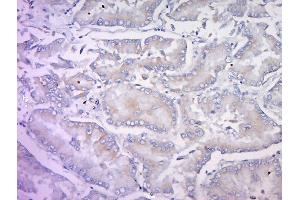 Immunohistochemistry (Paraffin-embedded Sections) (IHC (p)) image for anti-Integrin, alpha 5 (ITGA5) (AA 1021-1099) antibody (ABIN670221)