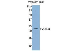 Western Blotting (WB) image for anti-Aldehyde Dehydrogenase 1 Family, Member A3 (ALDH1A3) (AA 332-509) antibody (ABIN1176368) (ALDH1A3 Antikörper  (AA 332-509))