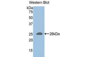 Western blot analysis of the recombinant protein. (ADAMTS1 Antikörper  (AA 258-467))