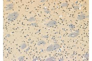 ABIN6261295 and ABIN6273110 at 1/100 staining Mouse brain tissue by IHC-P.