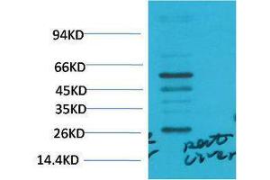 Western Blotting (WB) image for anti-Transforming Growth Factor, beta 1 (TGFB1) antibody (ABIN3181581) (TGFB1 Antikörper)