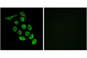 Immunofluorescence analysis of A549 cells, using RPS12 Antibody.