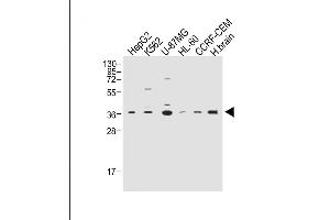 All lanes : Anti-Z Antibody (C-term) at 1:2000 dilution Lane 1: HepG2 whole cell lysate Lane 2: K562 whole cell lysate Lane 3: U-87MG whole cell lysate Lane 4: HL-60 whole cell lysate Lane 5: CCRF-CEM whole cell lysate Lane 6: Human brain whole tissue lysate Lysates/proteins at 20 μg per lane. (MPZ Antikörper  (C-Term))