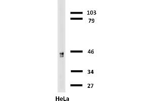 Western blotting analysis of human cytokeratin 18 using mouse monoclonal antibody C-04 on lysates of HT-29 cell line and MOLT-4 cell line (cytokeratin non-expressing cell line, negative control) under non-reducing and reducing conditions. (Cytokeratin 18 Antikörper  (Biotin))