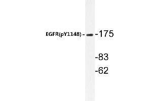 Western blot (WB) analyzes of p-EGFR antibody in extracts from HepG2 cells. (EGFR Antikörper  (pTyr1172))