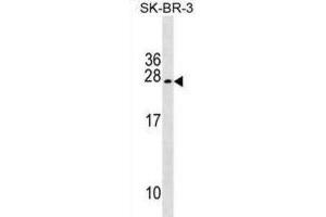 Western Blotting (WB) image for anti-Tumor Suppressor Candidate 5 (TUSC5) antibody (ABIN2999811) (TUSC5 Antikörper)