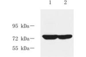 Western blot analysis of RASGRP3 (ABIN7075376) at dilution of 1: 1000,Lane 1:Rat liver tissue lysate,Lane 2: Rat kidney tissue lysate (RASGRP3 Antikörper)