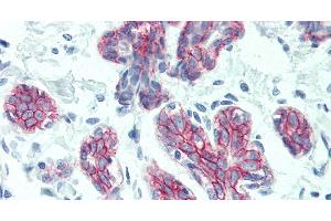 Immunohistochemistry of paraffin-embedded Breast tissue using DSG2 Polyclonal Antibody at dilution of 1:60. (Desmoglein 2 Antikörper)