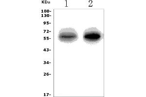 Western blot analysis of SLC1A3 using anti-SLC1A3 antibody (ABIN7601396).