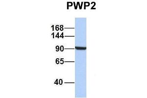 Host:  Rabbit  Target Name:  PWP2  Sample Type:  Jurkat  Antibody Dilution:  1. (PWP2 Antikörper  (Middle Region))
