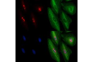 ABIN6263450 and ABIN6278413 staining  cells by IF/ICC.