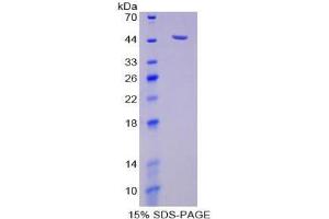SDS-PAGE analysis of Human Neuraminidase Protein. (NEU1 Protein)