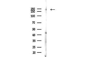 Western blot analysis of lysates from K562 cells(UV, 30 min treatment), using Phospho-ABL1(Tyr393)/ABL2(Tyr439) Antibody at 1/1000 dilution.