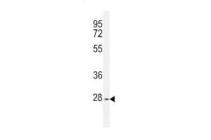 PTPN20A Antibody (Center) (ABIN655743 and ABIN2845189) western blot analysis in K562 cell line lysates (35 μg/lane). (PTPN20A Antikörper  (AA 178-207))