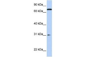 MAP4K1 antibody used at 1 ug/ml to detect target protein. (MAP4K1 Antikörper  (N-Term))