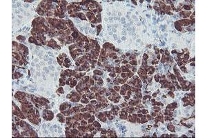 Image no. 1 for anti-Carboxypeptidase A2 (Pancreatic) (CPA2) antibody (ABIN1497595) (Carboxypeptidase A2 Antikörper)