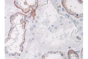 DAB staining on IHC-P; Samples: Human Kidney Tissue (SPARCL1 Antikörper  (AA 298-545))