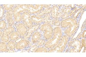 Detection of ADAMTS9 in Human Kidney Tissue using Polyclonal Antibody to A Disintegrin And Metalloproteinase With Thrombospondin 9 (ADAMTS9) (ADAMTS9 Antikörper  (AA 1727-1935))